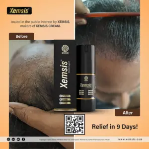 before and after scalp psoriasis skin condition