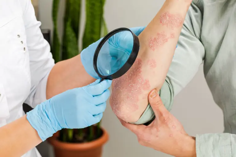 dermatologist-wearing-gloves-examines-skin-sick-patient-examination-diagnosis-skin-diseases-allergies-psoriasis-eczema-dermatitis-min